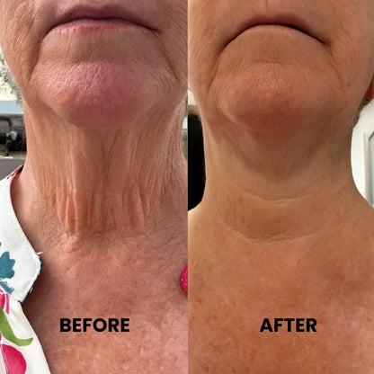 LumiSculpt™ LED Face Mask