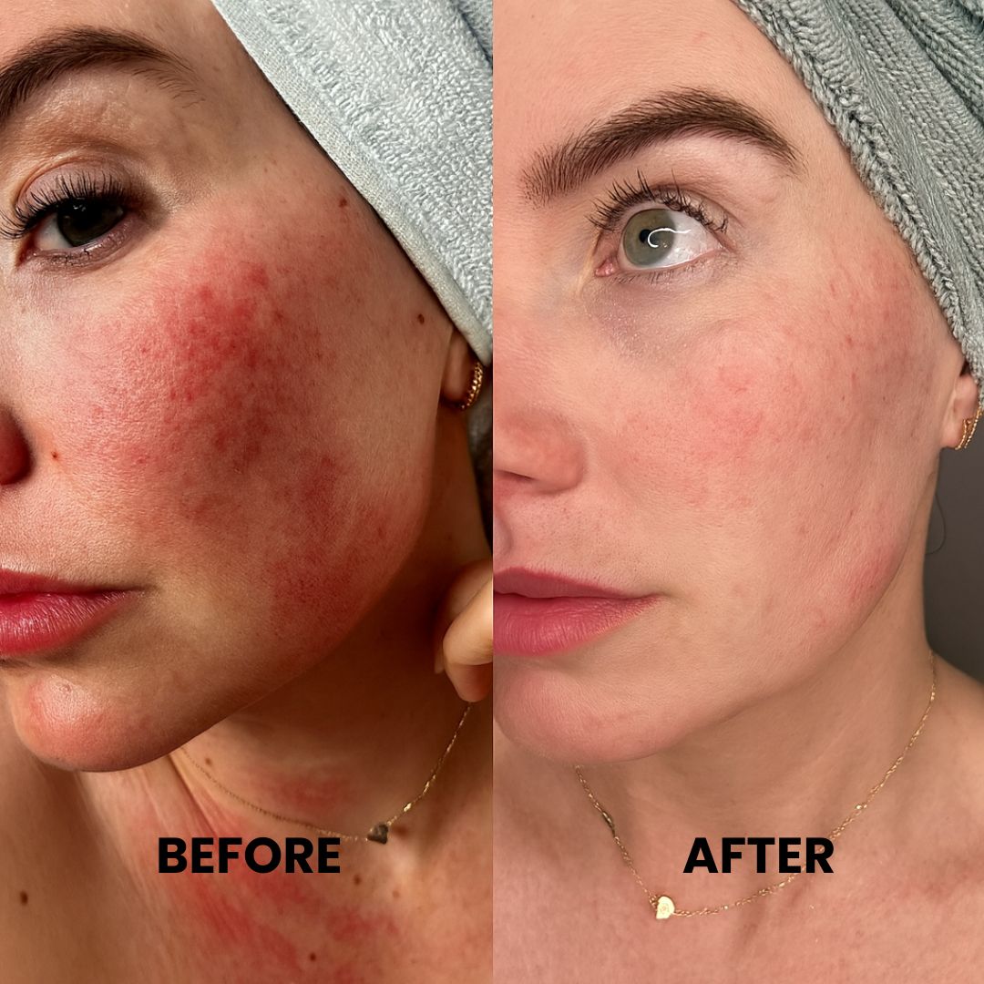 LumiSculpt™ LED Face Mask