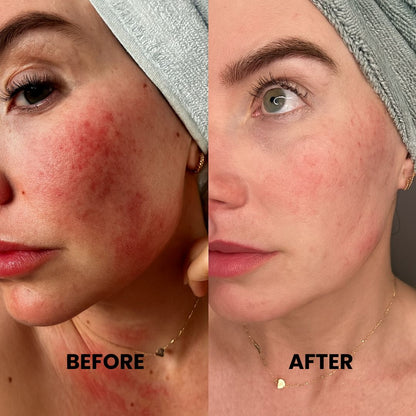 LumiSculpt™ LED Face Mask