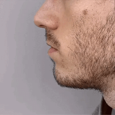 NasoWave™ Nasal Red Light Device