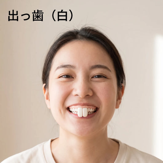 出っ歯 装着イメージ