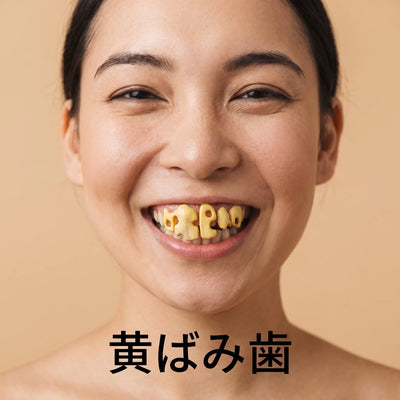 黄ばみ歯 装着イメージ